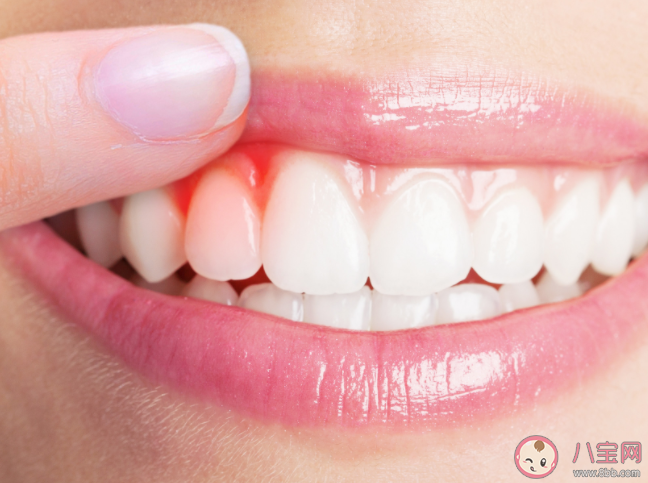 消腫鎮痛止血的牙膏真的有效果嗎 牙齦出血該怎么辦