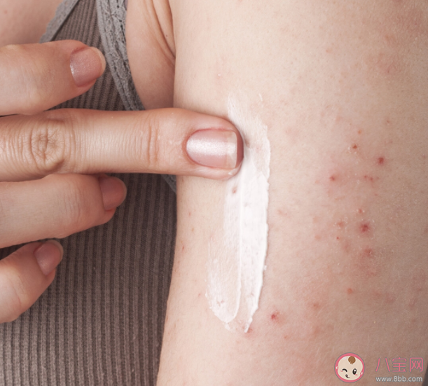 雞皮膚可以根治嗎 雞皮膚如何護理改善