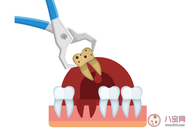 醫(yī)生建議上午拔牙的原因是什么 哪幾類人群拔牙一定要謹慎