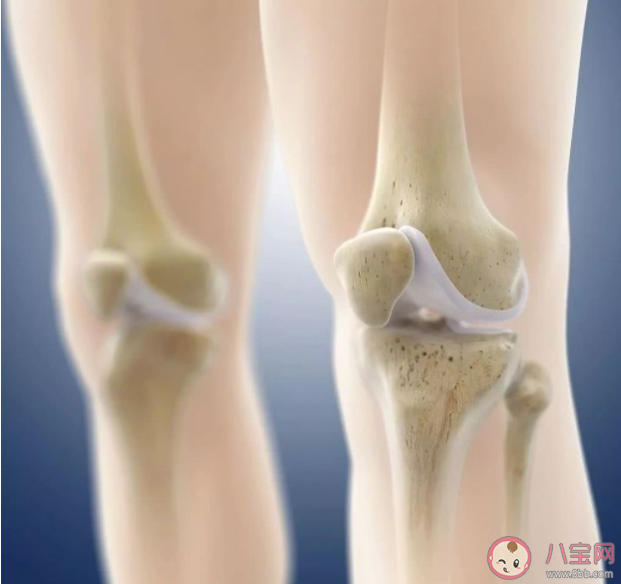 骨質疏松是如何發生的 吃鈣片就能預防骨質疏松嗎