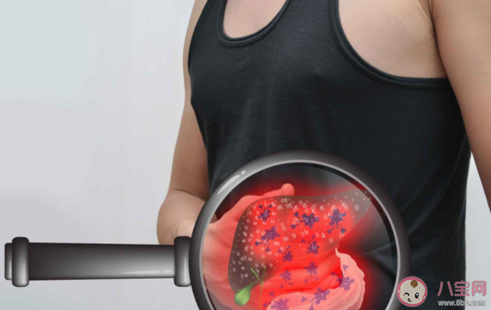 沒得過肝炎為什么會肝硬化 肝硬化患者如何保養 沒得過肝炎為什么會肝硬化 肝硬化患者如何保養