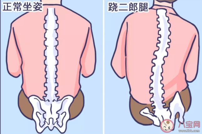 經(jīng)常蹺二郎腿有可能引起脊柱側(cè)彎嗎 螞蟻莊園10月28日答案