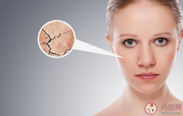 為什么一到秋冬季節就皮膚干燥 一到秋冬季就身體干燥怎么辦