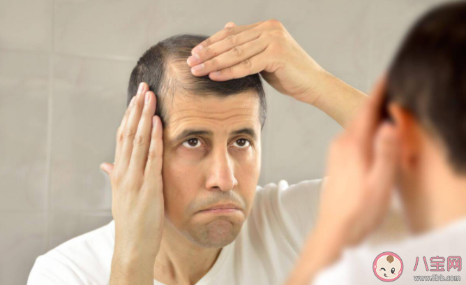 脫發是不是一種病 如何改善脫發癥狀 脫發是不是一種病 如何改善脫發癥狀