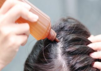 吃味精會(huì)讓人掉頭發(fā)是真的嗎 這些不靠譜的防脫發(fā)方法要注意