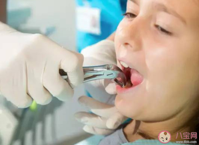 下午拔牙真的不好嗎 拔牙有哪些隱藏的高風(fēng)險(xiǎn) 下午拔牙真的不好嗎 拔牙有哪些隱藏的高風(fēng)險(xiǎn)