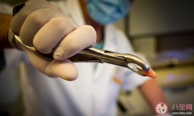 下午拔牙真的不好嗎 拔牙有哪些隱藏的高風(fēng)險(xiǎn) 下午拔牙真的不好嗎 拔牙有哪些隱藏的高風(fēng)險(xiǎn)