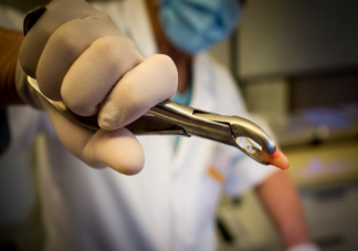 下午拔牙真的不好嗎 拔牙有哪些隱藏的高風(fēng)險(xiǎn)