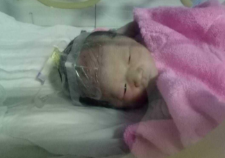 孕38周卸貨屬于早產嗎 預產期前出生的都是早產兒嗎