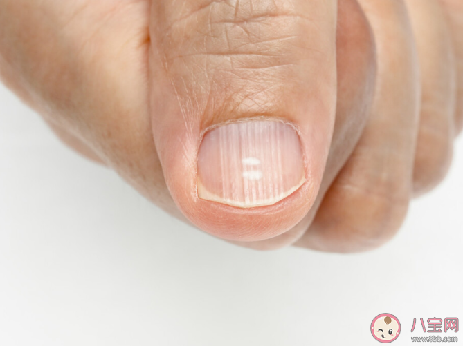 指甲上有豎紋是身體有大病的征兆嗎 螞蟻莊園11月5日正確答案