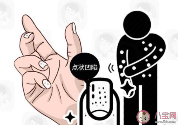 螞蟻莊園指甲上有豎紋是身體有大病的征兆嗎 11月5日答案介紹