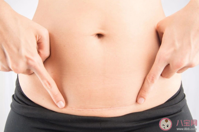 二胎剖腹產(chǎn)和第一胎剖腹產(chǎn)有什么區(qū)別 剖腹產(chǎn)媽媽生二胎注意什么