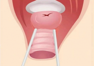 順產后陰道會變松弛嗎 順產下面變松弛多久能恢復