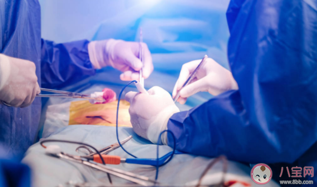 切除息肉疼不疼 腸息肉切除后怎么護理比較好 切除息肉疼不疼 腸息肉切除后怎么護理比較好