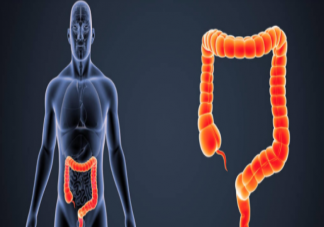 腸息肉都會癌變嗎 腸息肉的類型有哪些