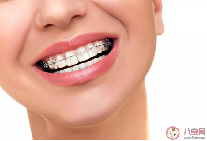 牙齒矯正時如何預防牙套臉 預防牙套臉的牙套操 牙齒矯正時如何預防牙套臉 預防牙套臉的牙套操
