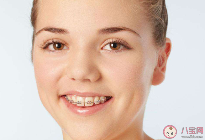 牙齒矯正時如何預防牙套臉 預防牙套臉的牙套操 牙齒矯正時如何預防牙套臉 預防牙套臉的牙套操