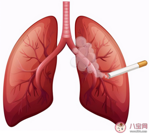 為什么很多女性不抽煙也會得肺癌 肺癌如何預防 為什么很多女性不抽煙也會得肺癌 肺癌如何預防