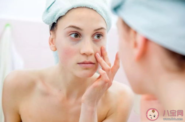 黑眼圈形成和入睡時(shí)間有關(guān)嗎 為什么沒有熬夜也有黑眼圈 黑眼圈形成和入睡時(shí)間有關(guān)嗎 為什么沒有熬夜也有黑眼圈