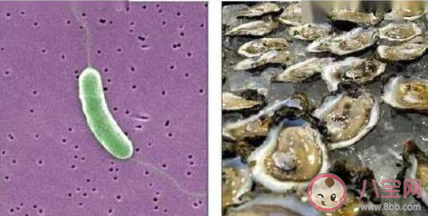 為什么被海鮮扎手可能喪命 被海鮮扎傷后該怎么辦 為什么被海鮮扎手可能喪命 被海鮮扎傷后該怎么辦