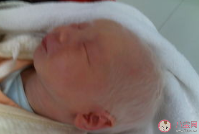 白化病是一種什么病 螞蟻莊園12月7日答案解析