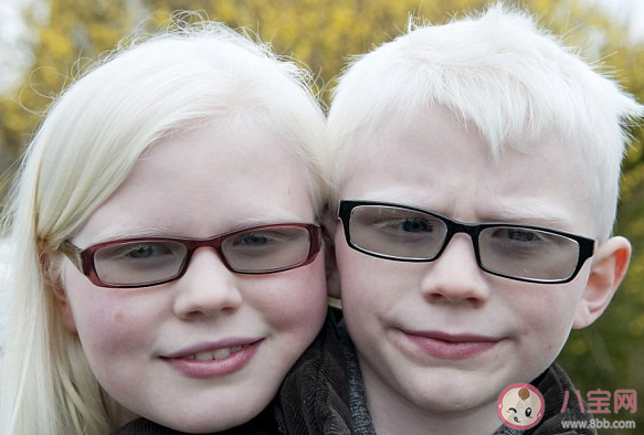 白化病是一種什么病螞蟻莊園 12月7日答案最新