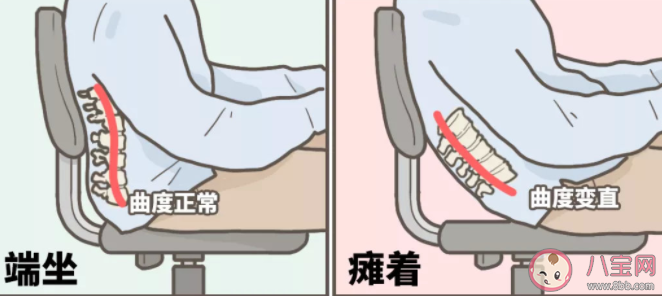 癱著這么舒服為什么會傷腰 有哪些常見的傷腰姿勢 癱著這么舒服為什么會傷腰 有哪些常見的傷腰姿勢
