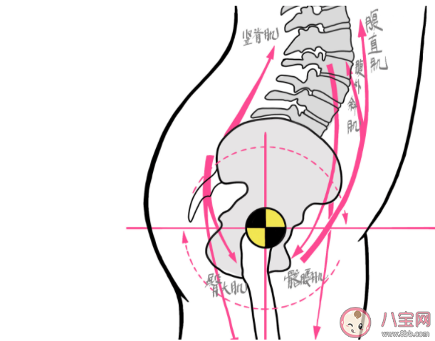 骨盆前傾的危害是什么 哪些人易出現(xiàn)骨盆前傾