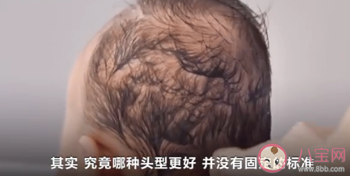 網紅矯正頭盔或影響嬰兒發育 定型枕定型頭盔有用嗎 網紅矯正頭盔或影響嬰兒發育 定型枕定型頭盔有用嗎