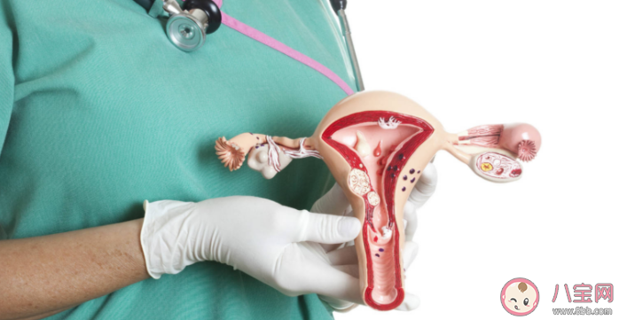 子宮肌瘤會引發哪些并發癥 子宮肌瘤要不要做手術