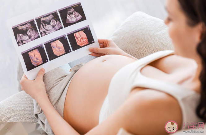 胎心監(jiān)測不合格是胎兒缺氧了嗎 胎心監(jiān)護每周都要做一次嗎