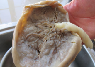 胎盤大補究竟是傳言還是真的 胎盤如何處理比較好