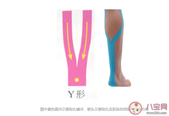 哪些情形可以用肌內效貼 肌貼到底應該怎么用 哪些情形可以用肌內效貼 肌貼到底應該怎么用