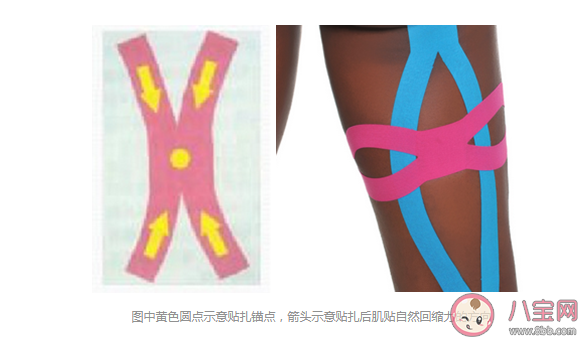 哪些情形可以用肌內效貼 肌貼到底應該怎么用 哪些情形可以用肌內效貼 肌貼到底應該怎么用