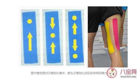 哪些情形可以用肌內效貼 肌貼到底應該怎么用 哪些情形可以用肌內效貼 肌貼到底應該怎么用