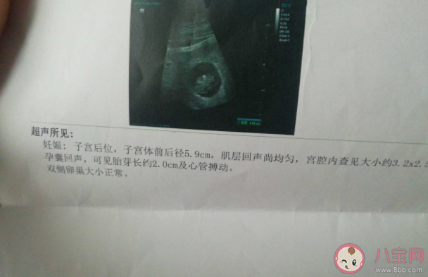 寶寶胎心胎芽一般幾周會(huì)有 孕檢不見(jiàn)胎芽胎心是有問(wèn)題嗎