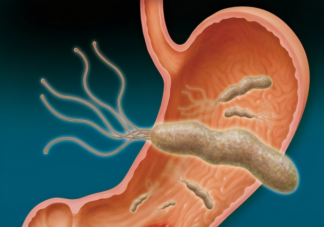 自己買試紙檢測(cè)幽門螺桿菌準(zhǔn)不準(zhǔn) 檢測(cè)幽門螺桿菌哪種方法更準(zhǔn)確