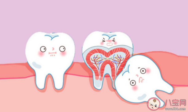 智齒是如何被拔出的 哪種智齒必須要拔 智齒是如何被拔出的 哪種智齒必須要拔