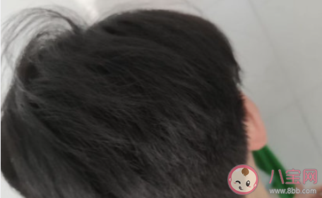 壓力會導致頭發變白嗎 真的有一夜白頭嗎