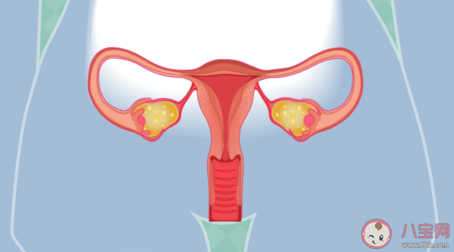 沒結婚會得子宮內膜異位癥嗎 得了子宮內異癥的人有哪些不適