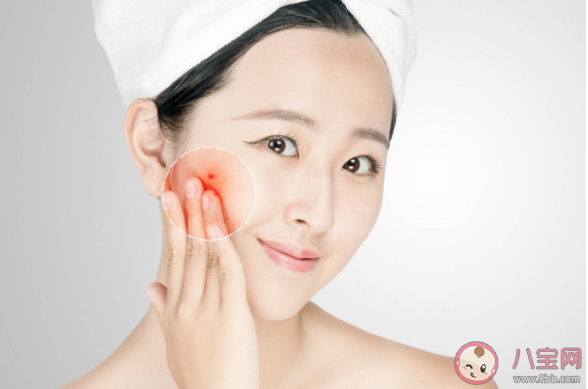 長痘痘和性生活有關系嗎 青春期痘痘和成人痘有什么不同