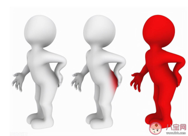 痔瘡手術之后多久能恢復正常生活和工作 痔瘡什么程度需要做手術 痔瘡手術之后多久能恢復正常生活和工作 痔瘡什么程度需要做手術