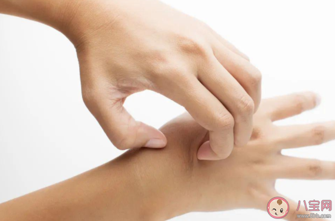 什么季節容易長濕疹 做好哪些事能有效預防濕疹