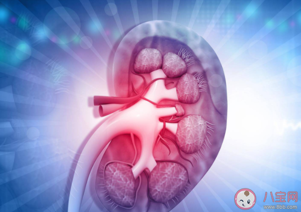 多喝可樂能溶解腎結石嗎 生活中如何預防腎結石