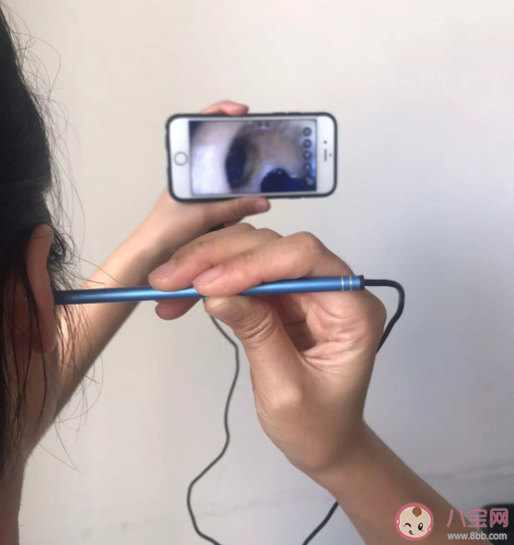 可視挖耳勺能帶來掏耳自由嗎 頻繁掏耳朵會有什么危害 可視挖耳勺能帶來掏耳自由嗎 頻繁掏耳朵會有什么危害