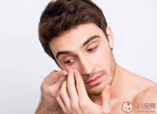 干眼癥就是眼睛缺水嗎 干眼癥能根治嗎 干眼癥就是眼睛缺水嗎 干眼癥能根治嗎