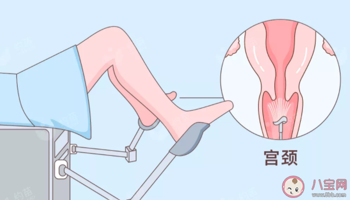 打HPV疫苗還要做宮頸癌篩查嗎 為什么很多女性有宮頸癌焦慮 打HPV疫苗還要做宮頸癌篩查嗎 為什么很多女性有宮頸癌焦慮