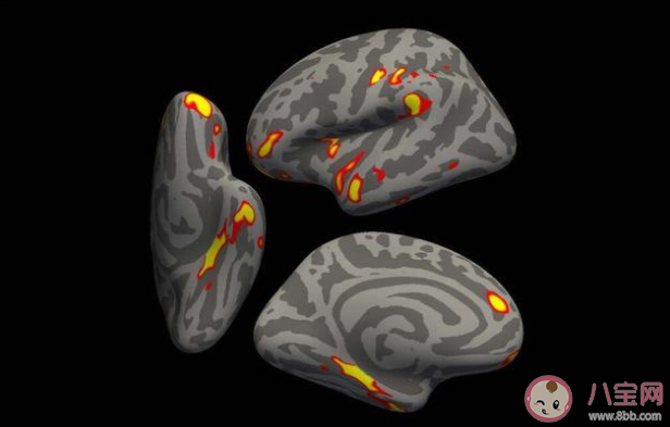 新冠或致大腦萎縮使人提前老10歲 怎么延緩大腦衰老 新冠或致大腦萎縮使人提前老10歲 怎么延緩大腦衰老