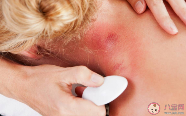 排毒騙局的10個真相 人體真的需要排毒嗎