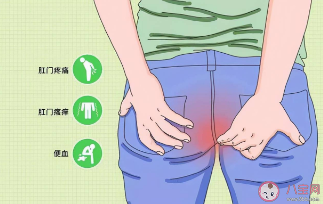 肛門指檢可以自己做嗎 做肛門指檢前要注意什么 肛門指檢可以自己做嗎 做肛門指檢前要注意什么